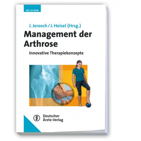Management der Arthrose